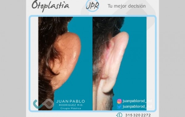 Caso 94